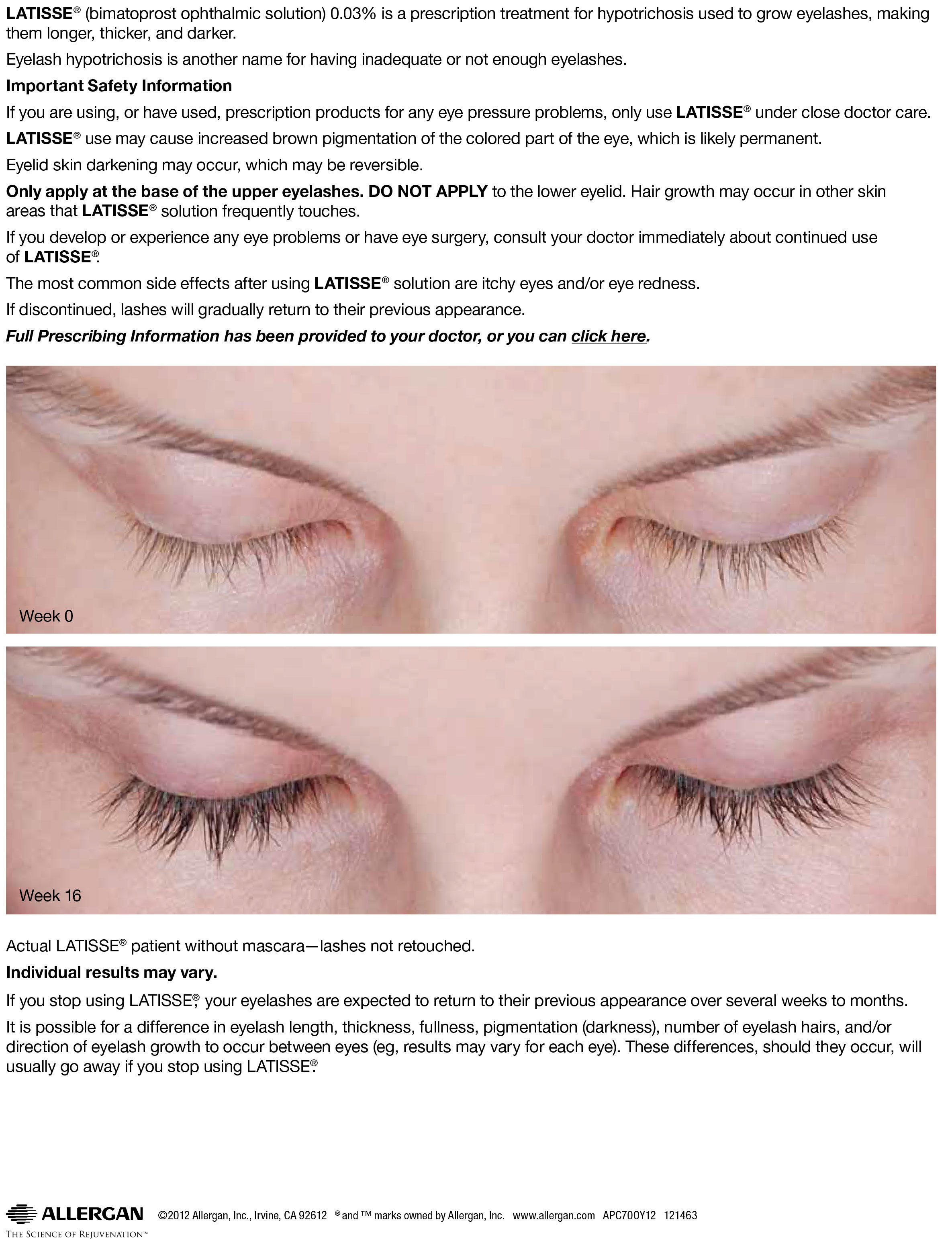 Latisse clinical results 2