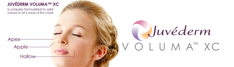 juvederm voluma xc
