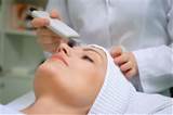 ipl laser treatment