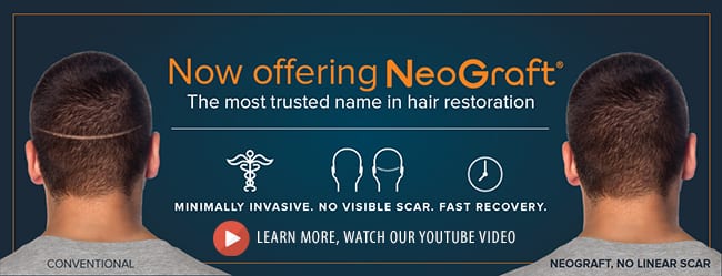 La Bella Vita Medi Spa in Rocklin now offers NeoGraft hair transplants