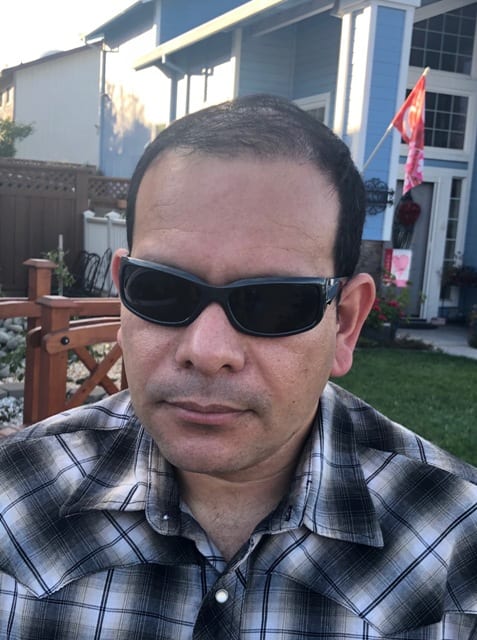 best hair restoration treatment roseville ca