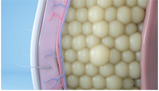 Coolsculpting elite targets stubborn fat