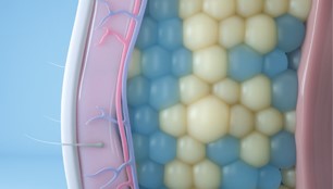 Coolsculpting Elite targets and freezes fat