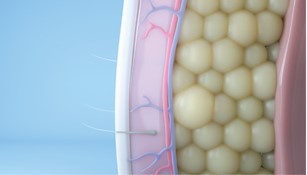 after Coolsculpting elite treatment your body eliminates dead fat cells